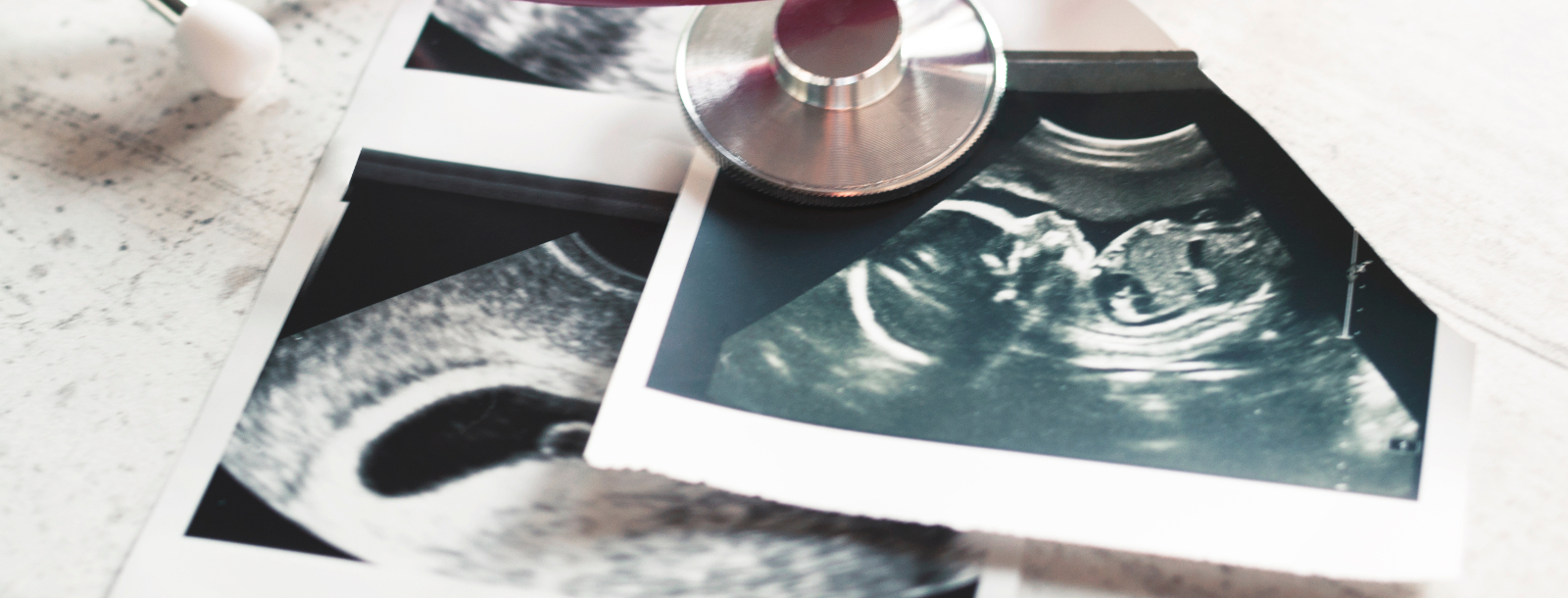 British Indians are aborting girls in record numbers. But honestly, who’s even surprised?